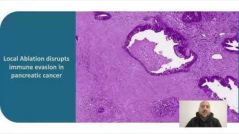 Stereo-seq Webinar | Revolutionizing Research with Spatial Transcriptomics