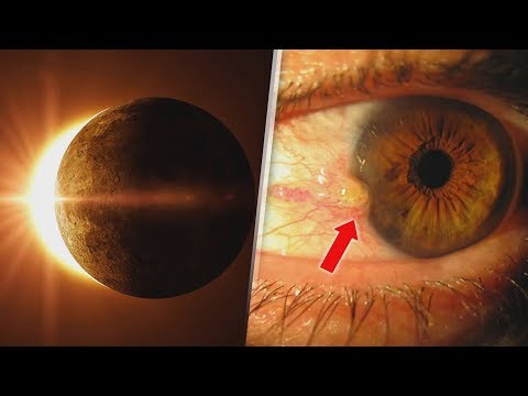 Vídeo: O Homem Diz O Que Acontece Se Você Assistir Um Eclipse