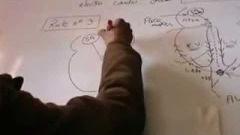 CVS ECG Part 1 Dr Mohamed Fayez