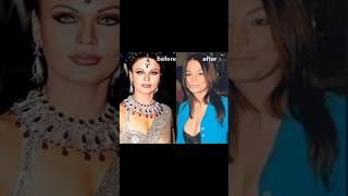 Worst Plastic Surgery ??bollywood youtubeshorts