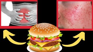 Why Eating Outside Food Causes Crazy Reactions In Your Body