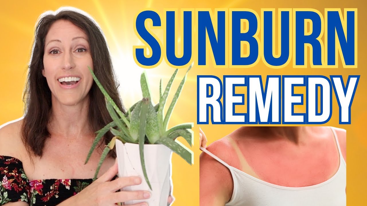 2 Powerful Natural Remedies For Sunburns  FAST Sunburn Relief for Pain &  Reduces Peeling 
