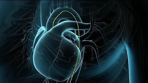 Coronary Angioplasty Surgery | Balloon Angioplasty | Nucleus Health