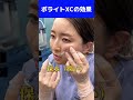 【新治療】1回の治療で9ヶ月保湿するヒアルロン酸がすごい#shorts #保湿 #シワ