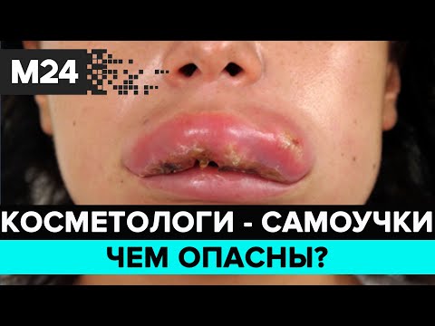 Бейне: Марина Хлебниковаға косметологпен шұғыл кеңес беру ұсынылды