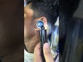 #耳垢の #ear #cleaning #removal #shorts