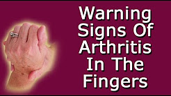 Warning Signs Of Arthritis In The Fingers