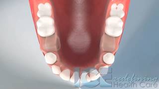 Dental Development Lower Occlusal View