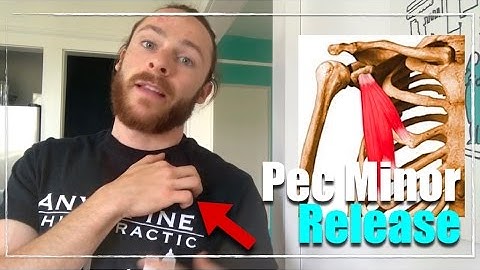 Pec Minor Release for Rounded Shoulders | Any Spine Chiropractic
