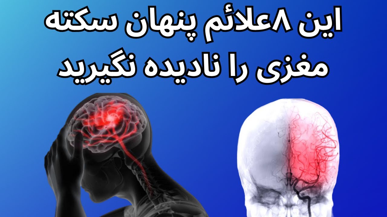 این ۸علائم پنهان سکته  مغزی  را نادیده نگیرید