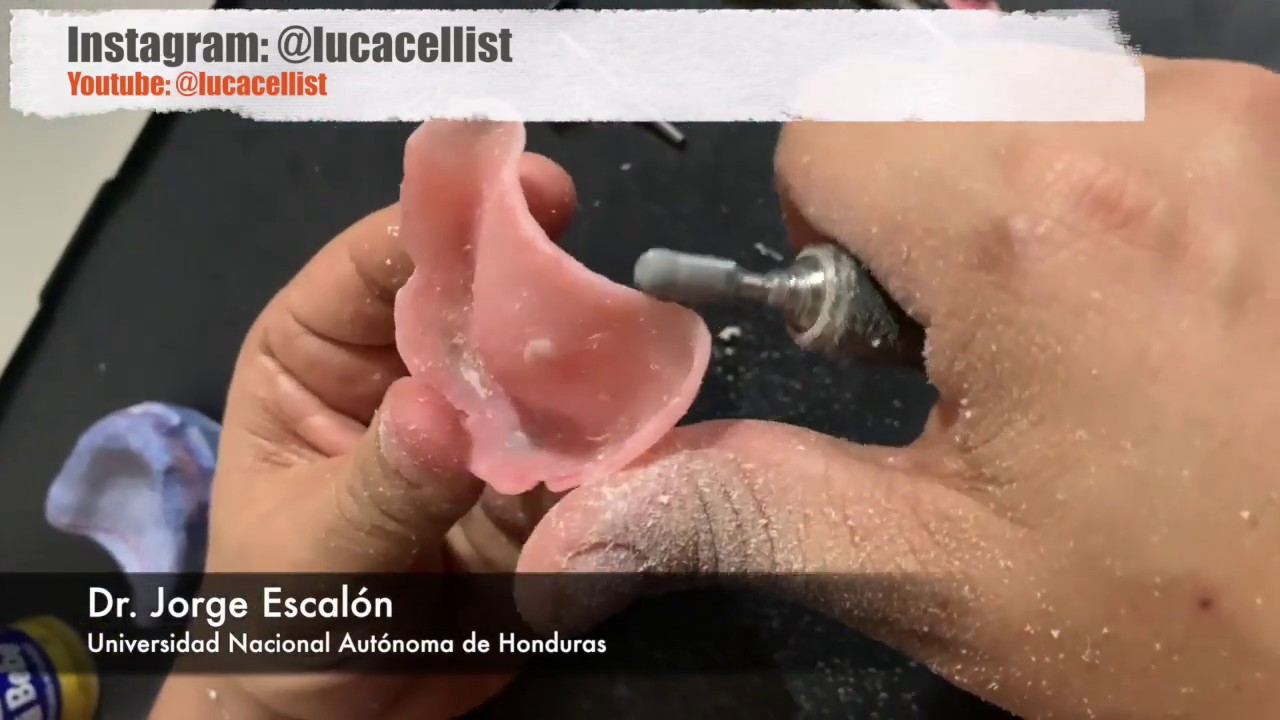 Placas Bases y Rodillos De Oclusión por el Dr. Jorge Escalón