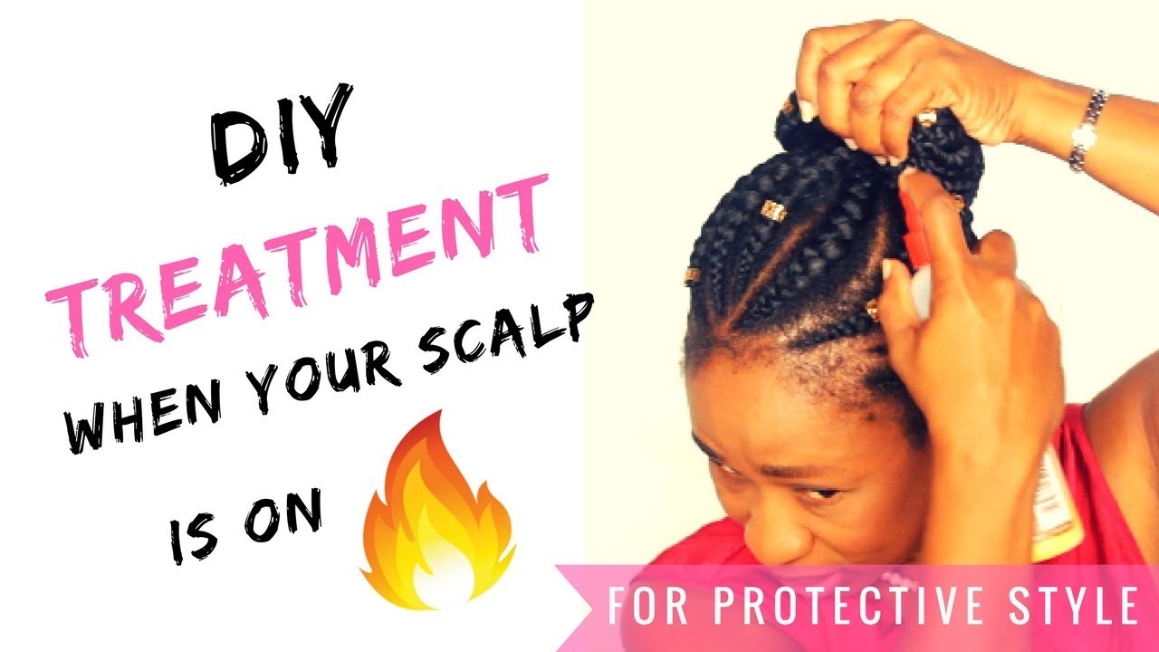 Diy Itchy Scalp Treatment Relaxed Hair YouTube Diy itchy scalp treatment relaxed hair youtube
