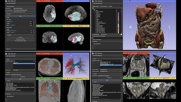 Automatic multi modality AI medical image segmentation in 3D Slicer using MONAIAuto3DSeg extension