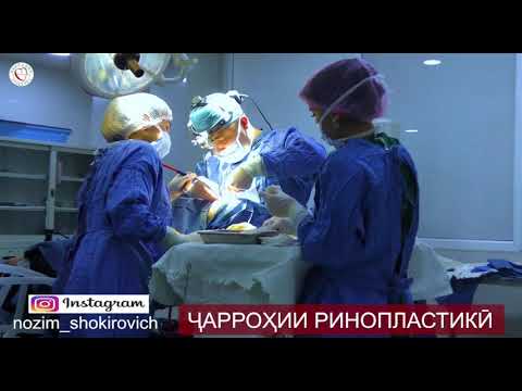 Нозим Шокирович. Ринопластика носа. Душанбе Таджикистан.