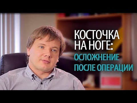 Косточка на ноге (hallux valgus): частые осложнения после удаления косточки на ноге Доктор Олейник
