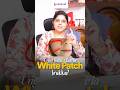 White Patches on Child’s Face? | Dermatologist Explains in Tamil #chennaidoctors #dermatology