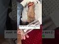 Cannula Insertion ✅#nurse #nursing #nurseryrhymes #mbbs #ytshorts #neet #doctor #hospital #youtube