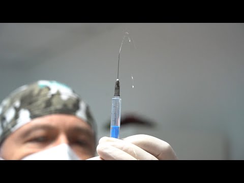 Видео: Ваксина срещу рубеола в подготовка за бременност