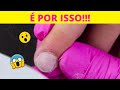 😮 Por Que A Unha Não Pode Estar Comprida Para Fazer Alongamento de Unhas?