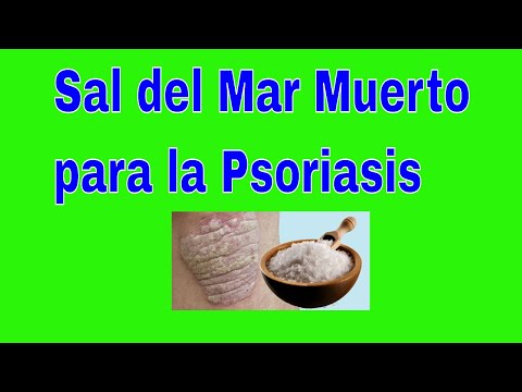 Sal del Mar Muerto para la Psoriasis