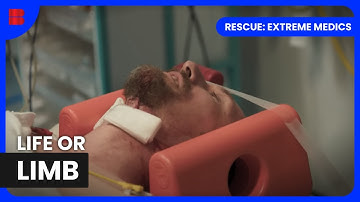 Chainsaw Accident: Emergency Response | Rescue: Extreme Medics