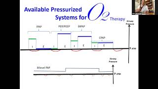 CPAP/BiPAP Pt. 3 - Chrono Physiopathology of COVID19 Pulmonary Infection