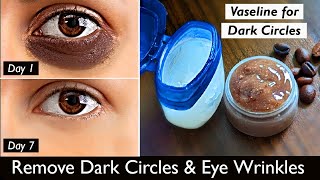 Remove DARK CIRCLES in 5 Days | Under Eye WRINKLES, Eye Bags - Vaseline Coffee Eye Mask & Eye Gel