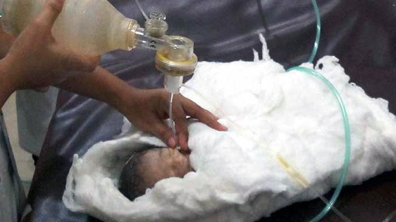 মৃত নবজাতক শিশুটি এখনও বেঁচে আছে ‘Dead’ Newborn Baby is still Alive
