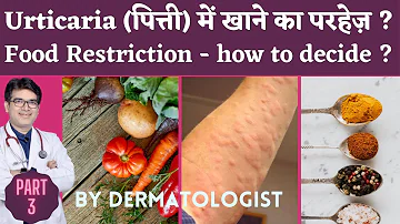 Urticaria me kya khana chahiye | Facts About Food to Avoid In Urticaria | Urticaria Part 3 Video