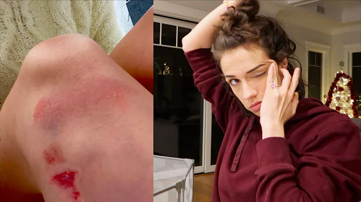 I fell... :(