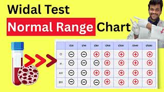 Widal Test Normal Range Chart | Widal Test Normal Level
