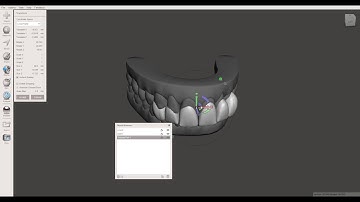 Waxup of anterior teeth in Meshmixer