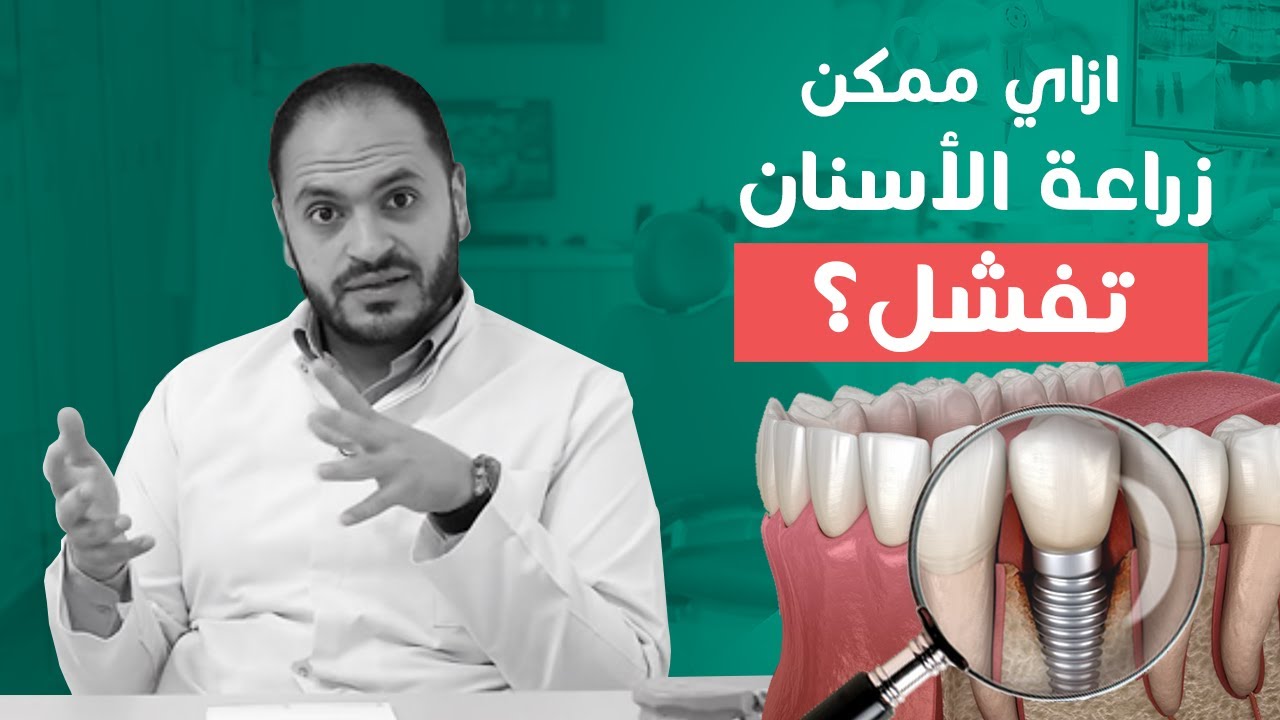 خلي بالك من العلامات دي لأن الخسارة كبيرة | أعراض فشل زراعة الاسنان المبكرة و المتأخرة و الفورية