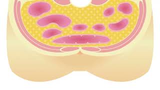 TOFI: The Hidden Health Risk in Slim Bodies