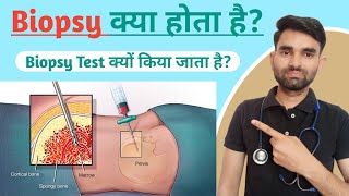 Biopsy Test kaise hota hai | Biopsy kya hota hai | Biopsy test in hindi