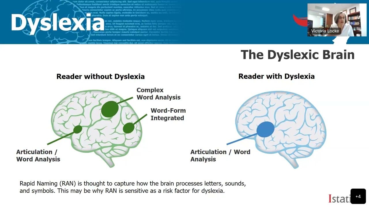 ⁣Helping Your Teachers Understand Dyslexia in the Elementary Classroom