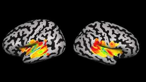 Cochleotopic Mapping of Human Auditory Cortical Fields
