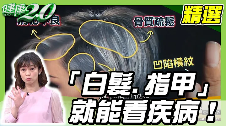 身體好不好「白髮、指甲」就能看疾病！改善白髮這樣做【@tvbshealth20 精選】 - 天天要聞