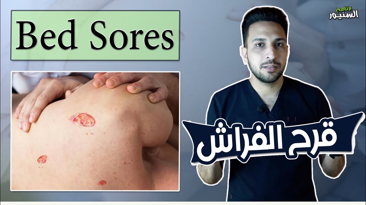 قرح الفراش Bed sores YouTube