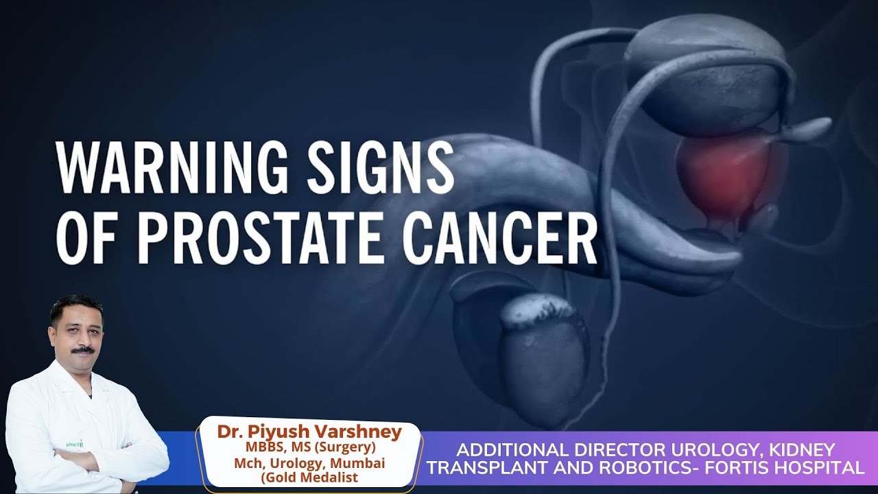 Prostate Warning Add Warning Sign of Prostate Cancer | Dr piyush Varshney #kidney # ...