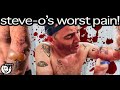 The horrific details of my most painful injury ever  steveo