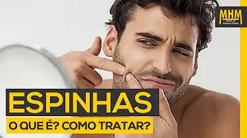 Qual a causa das espinhas nos homens?