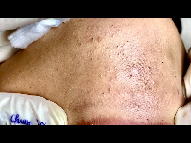 Satisfying video with Chung Vo Spa | 225