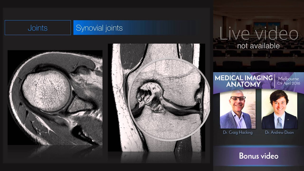 Types of Joints - Medical Imaging Anatomy Course - YouTube