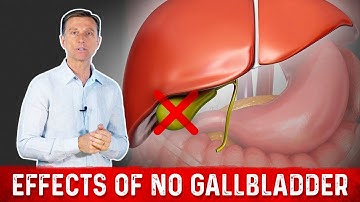 Gallbladder Function: What You MUST Know If You Don