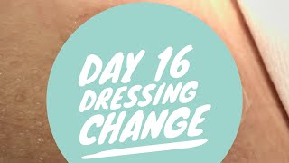 Day 16 Knee Abscess Wound Dressing Change