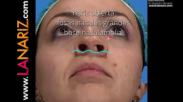 ¿Qué raza tiene la nariz estrecha?