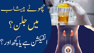 Urinary Tract Infection Symptoms & Treatment | Peshab Mein Infection Or Jalan