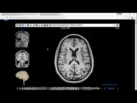 Vídeo: Respuesta A La Estimulación Inmunitaria Periférica Dentro Del Cerebro: Perspectiva De Resonancia Magnética Del éxito Del Tratamiento