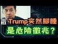特朗普突然腳腫手背出現瘀痕 這會是嚴重疾病嗎 Trump S Symptoms Is It Serious 特朗普突然腳腫手背出現瘀痕 這會是嚴重疾病嗎 Trump S Symptoms Is It Serious